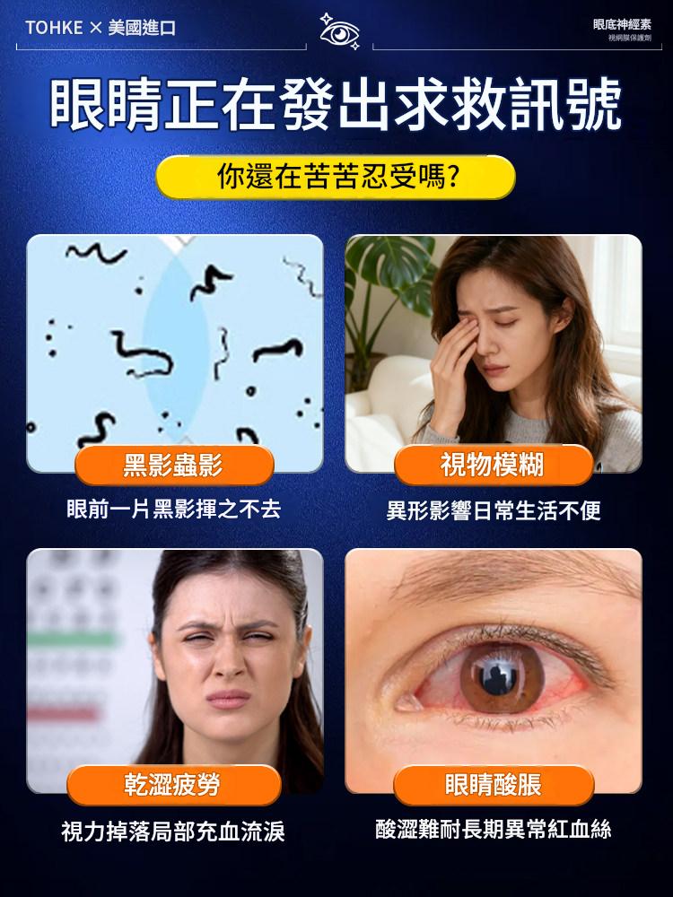 【銷售10W+】進口葉黃素保護眼膠囊視力疲勞中老年成人專用官方旗艦店原廠正品
